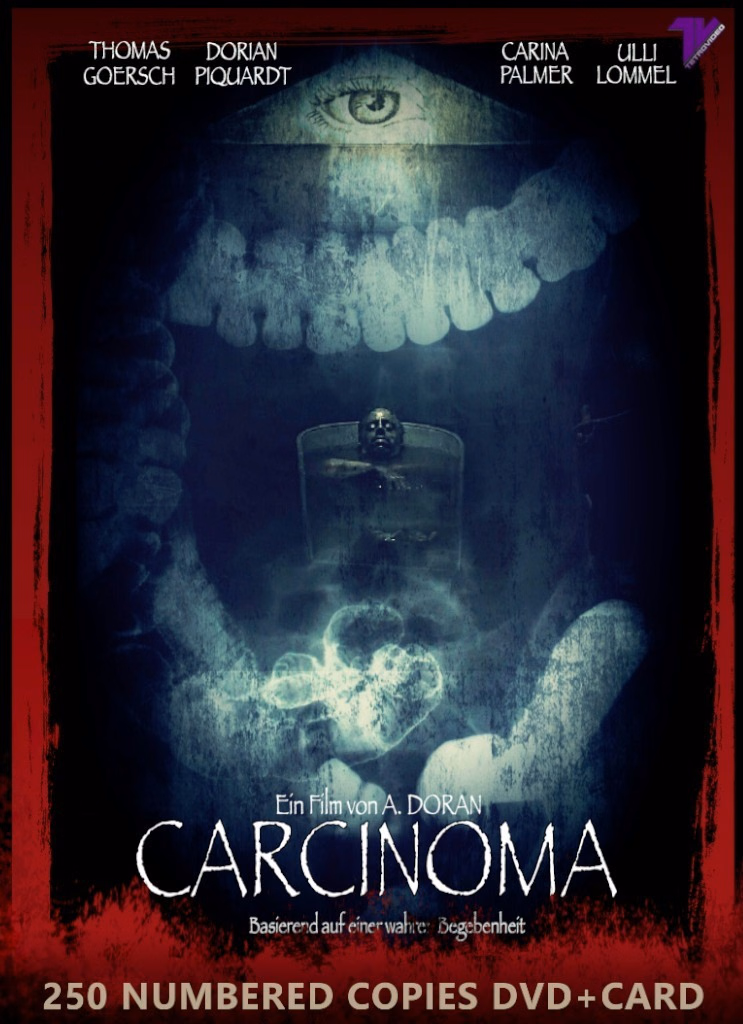 Carcinoma · TetroVideo · DVDPACK · Slipcase / Sammelkarte