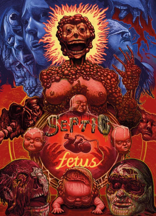 Fetus / Septic (Double Feature) · UncutTV / UltraVisual Films · Cover C · Kit Gallery
