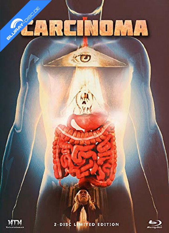 Carcinoma · MTM Entertainment · Cover A · 24-seitiges Booklet