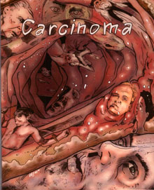 Carcinoma · PCM · Blu-ray im Pappschuber · PCM