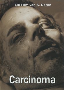 Carcinoma · Shock DVD Entertainment · Slipcase · 4 Sammelkarten